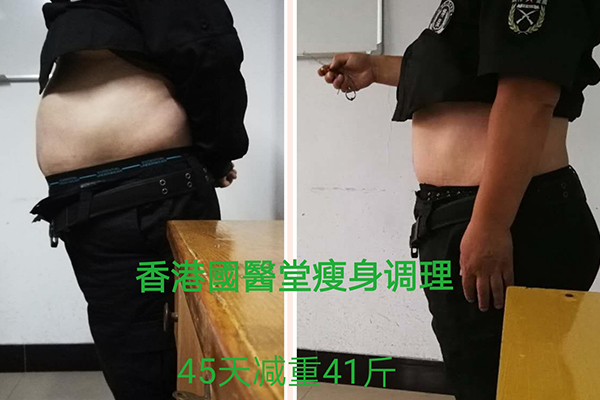 北京中药热敷包女子综合减肥有用吗