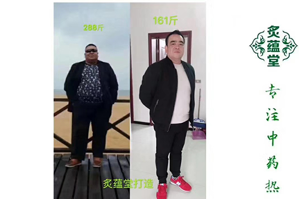 北京瘦瘦包月经量少减肥有用吗
