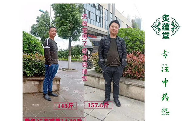 北京瘦瘦包月经期综合症减肥有用吗